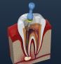 Best Dental Hospital in Latur | Premier Dental Care