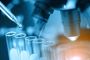 Reliable Rapid Diagnostic Test Kits for Accurate Results