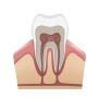 Comprehensive Root Canals Treatment Services in Jasper, AL