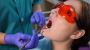 Periodontal Treatment Wauwatosa WI - Save Your Gums, Save Yo