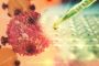 Best Cancer dietitian In UK