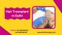 Hair Transplant in Delhi