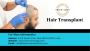 Hair Transplant in India