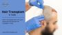 Best Hair Transplant in India