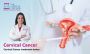 Best Cervical Cancer Treatment Doctor in Whitefield, Manipal