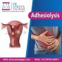 Best Adhesiolysis Surgery in Whitefield, Manipal - Dr. Aneet
