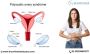 Best PCOS Treatment in Bangalore - Dr. Sumit Talwar