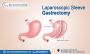 Best Laparoscopic Sleeve Gastrectomy Treatment in Bangalore 