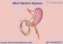 Best Laparoscopic Mini Gastric Bypass Treatment in Bangalore