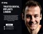 Looking For Dental Implants In London? 