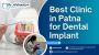  Best Dental Implant in Patna at Dr. Aishwarya’s Clinic