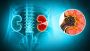 Kidney Stone Treatment in Pune - Dr. Akhil S Mane