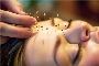 Acupuncture Clinic in Chicago