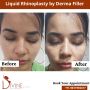  Nose Plastic Surgery Cost in Delhi, India – Rhinoplasty