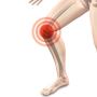 How Much Does Knee Replacement Surgery Cost in Delhi
