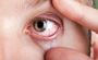 Why Your Vision Blurs After Too Much Screen Time And How to 