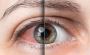How to Protect Your Eyes from UV Damage?