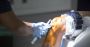 Get Expert Knee Replacement in Siliguri With Confidence