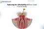 Exploring the Affordability of Root Canal Cost In India
