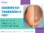 Get Affordable & Reliable Hair Transplant in Pune | Dr. Hite