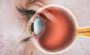 Best Retina Treatment in Andul Howrah