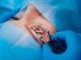 Cornea and Refractive Treatment Specialist in Andul  