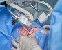 Best Cataract Surgery in Howrah for Clear Vision  