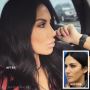 Plastic Surgery Clinic in New York City for Rhinoplasty