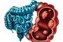 Best Malignant Intestinal Disease Treatment in Gujarat