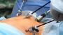 Expert Laparoscopic Surgeon in Ahmedabad – Dr. Jigar Patel