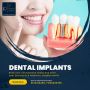 Upgrade Your Smile with Dental Implants!