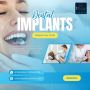 Restore Your Smile with Dental Implants in Gurgaon