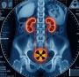 Best Vesicoureteric Reflux Surgeons in Sarjapur Road