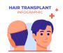 Natural Hair Transplant Results for Men
