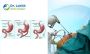 Bariatric & Weight Loss Surgery in Bangalore - Dr. Lohith U