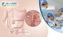 Best Hernia Surgery in Bangalore - Dr. Lohith U