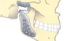TMJ Replacement Surgery - Best oral and maxillofacial surgeo