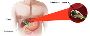Expert Gallbladder Cancer Treatment in Ludhiana