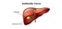 Best Gallbladder Cancer Treatment in Ludhiana