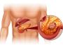 Expert Liver and Pancreas Specialist in Ludhiana