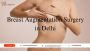 Breast Augmentation Surgery in Delhi - Dr. Priya Bansal