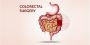 Expert Colorectal Surgery in Indore – Dr. Rakesh Dhupia