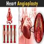 Angioplasty and Stent Placement for the Heart | Dr. Ravinder