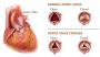 Heart Valve Expert in Milap Nagar, Jaipur | Dr. Ravinder Sin