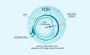 ICSI Treatment in Delhi - Dr Rhythm Gupta