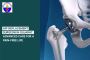 Hip Replacement Surgeon in Ahmedabad for Pain-Free Living
