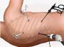 Thoracoscopy Treatment in India - Dr. Sheetu Singh