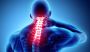 Cervical Spondylosis Treatment & Neck Pain Doctor in Delhi