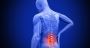 Lumbar Spondylosis Treatment & Spine Doctor in Delhi