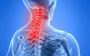 Neck & Cervical Pain Treatment by Specialist in Delhi